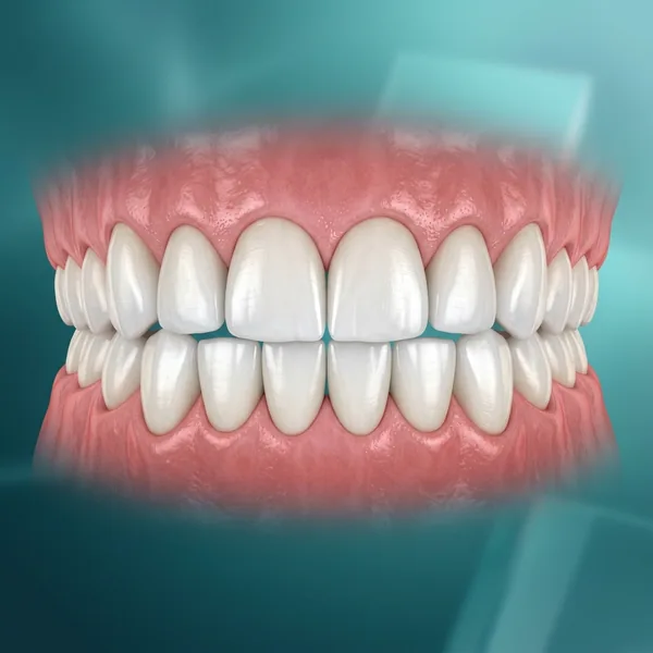 Cosmetic dentistry smile design treatment
